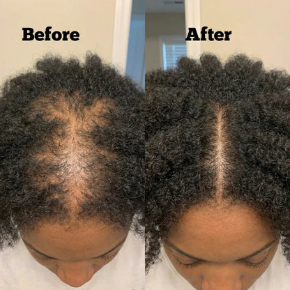 Revive™ Batana Oil
